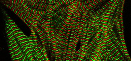 Muscle Biology Section_Image 1(420x195)